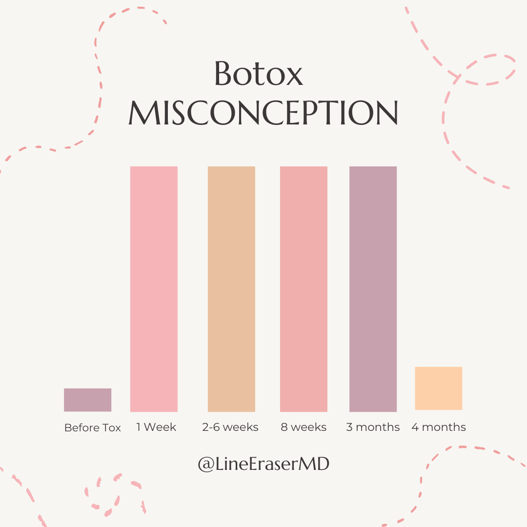 botox misconception