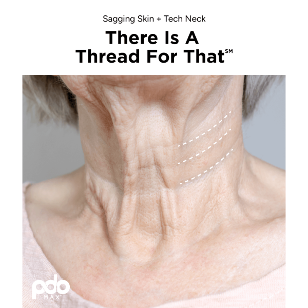 neck threads